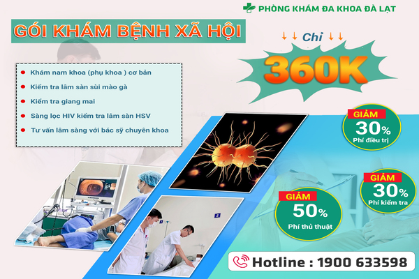 Hình ảnh minh họa